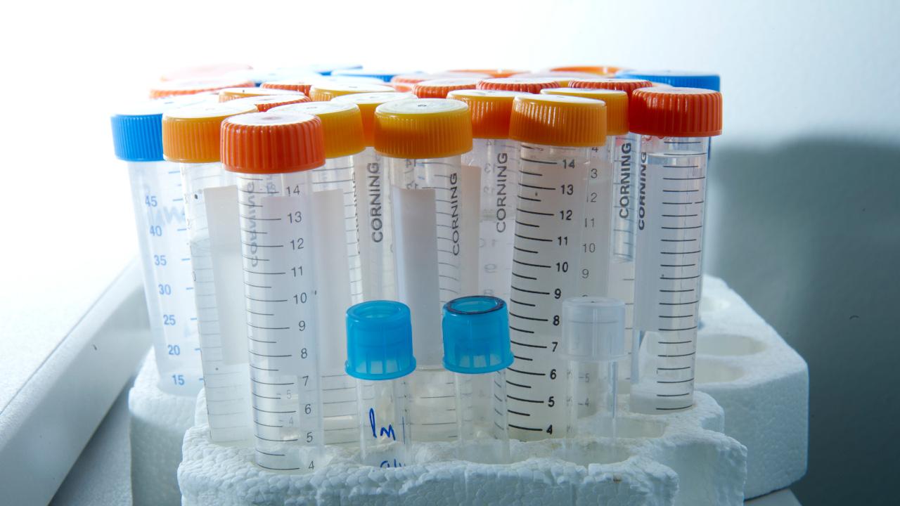 Gregory Urquiaga/UC Davis Picture with multiple test tubes