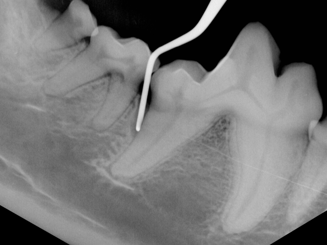 Dentistry Radiograph