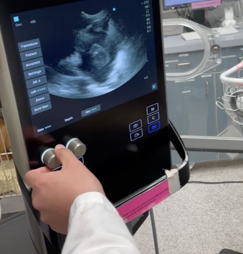 Ultrasound Photo