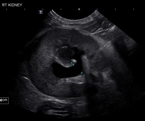Ultrasound Photo